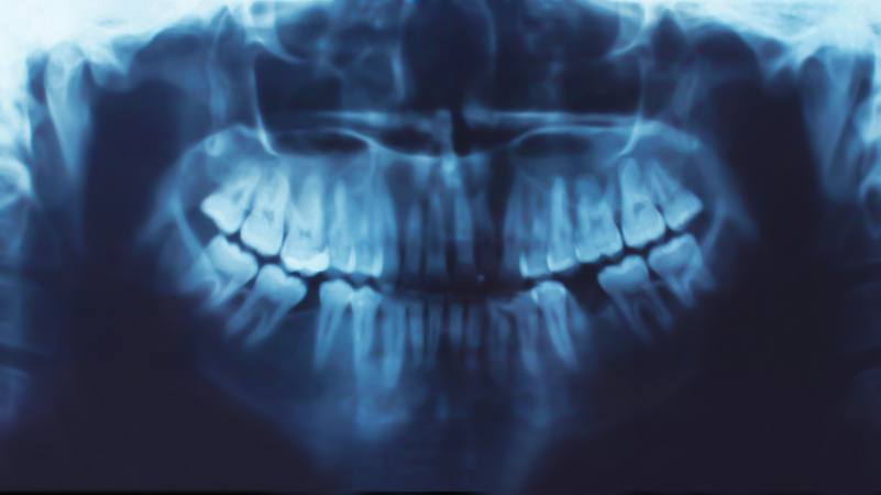 Dentist In Worcester | Dental X ray