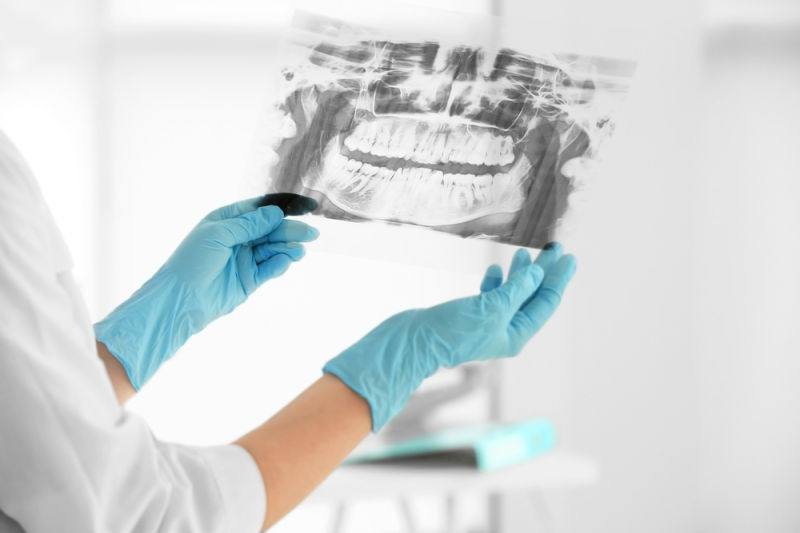 dentist in worcester | dental care x-ray
