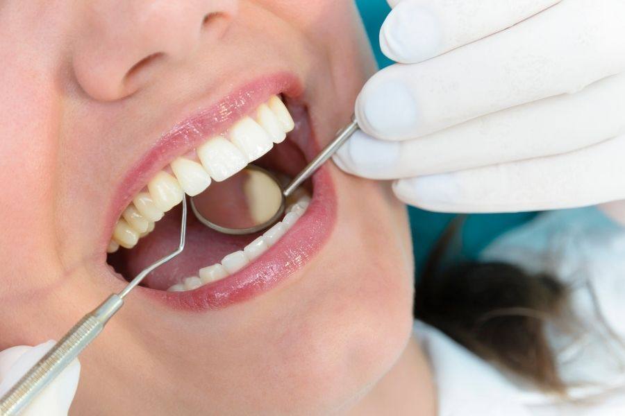 Dental Filling Closeup | Dentist Worcester