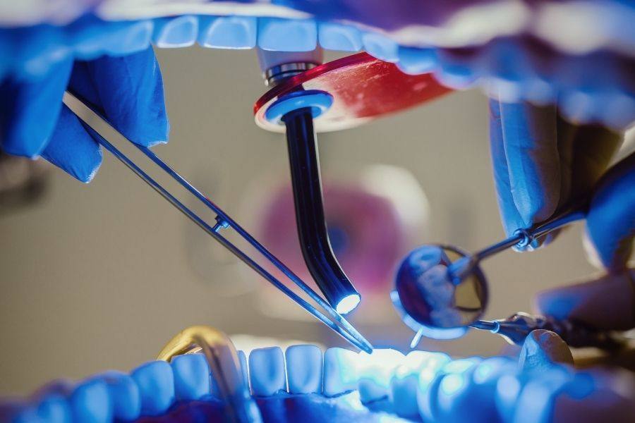 Dental Filling Procedure | Dentist Worcester